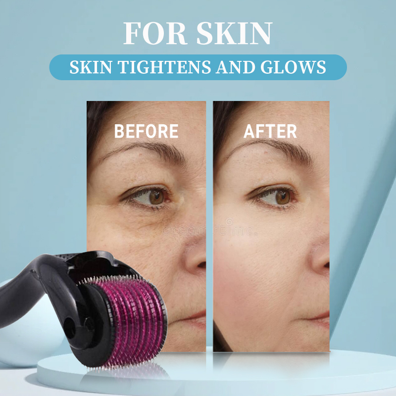Professional 540 Roller Derma  - Derma Roller 0.25 ulasan dan harga